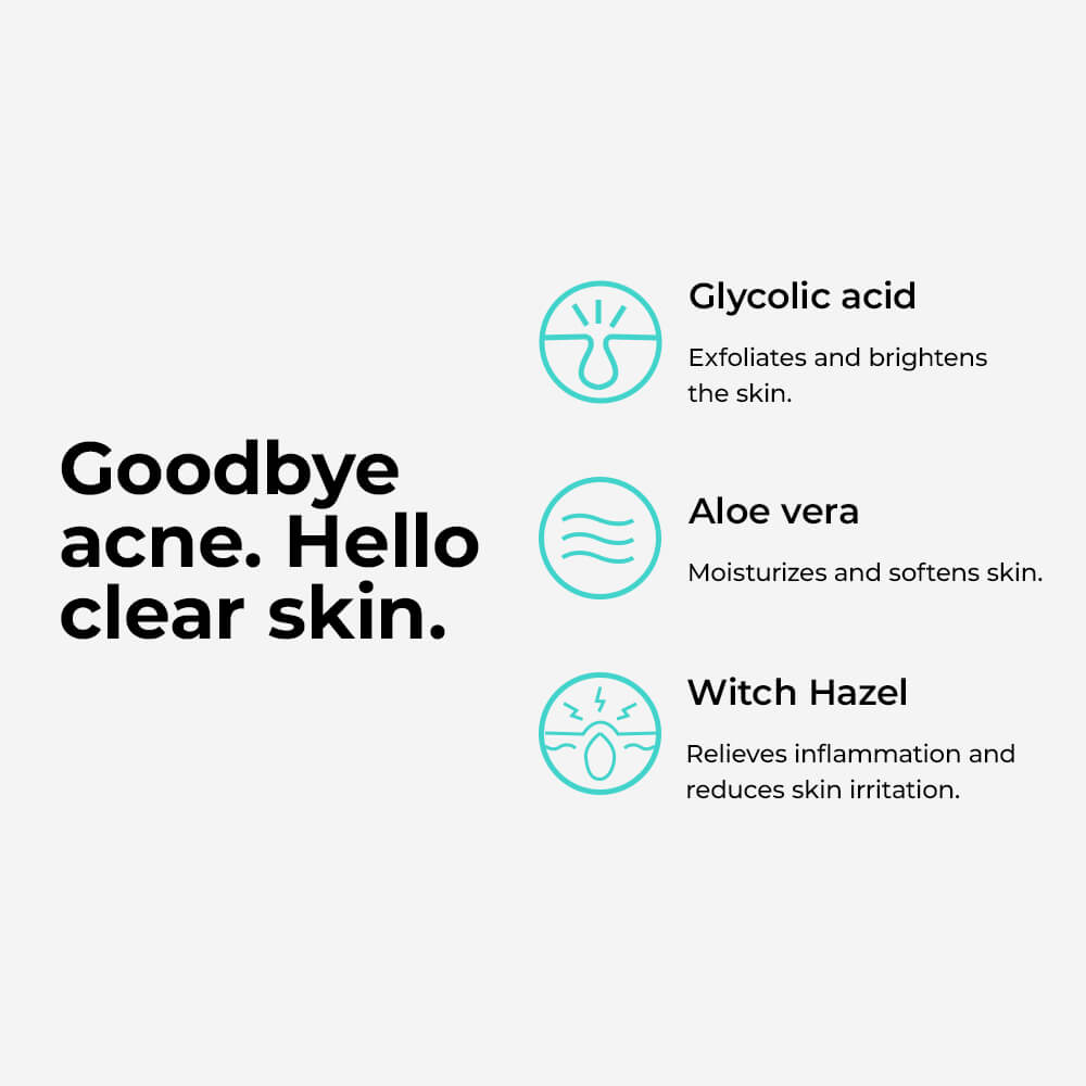 Anti-Acne Witch Hazel Toner with 2% glycolic acid - Skin Chemistry Official